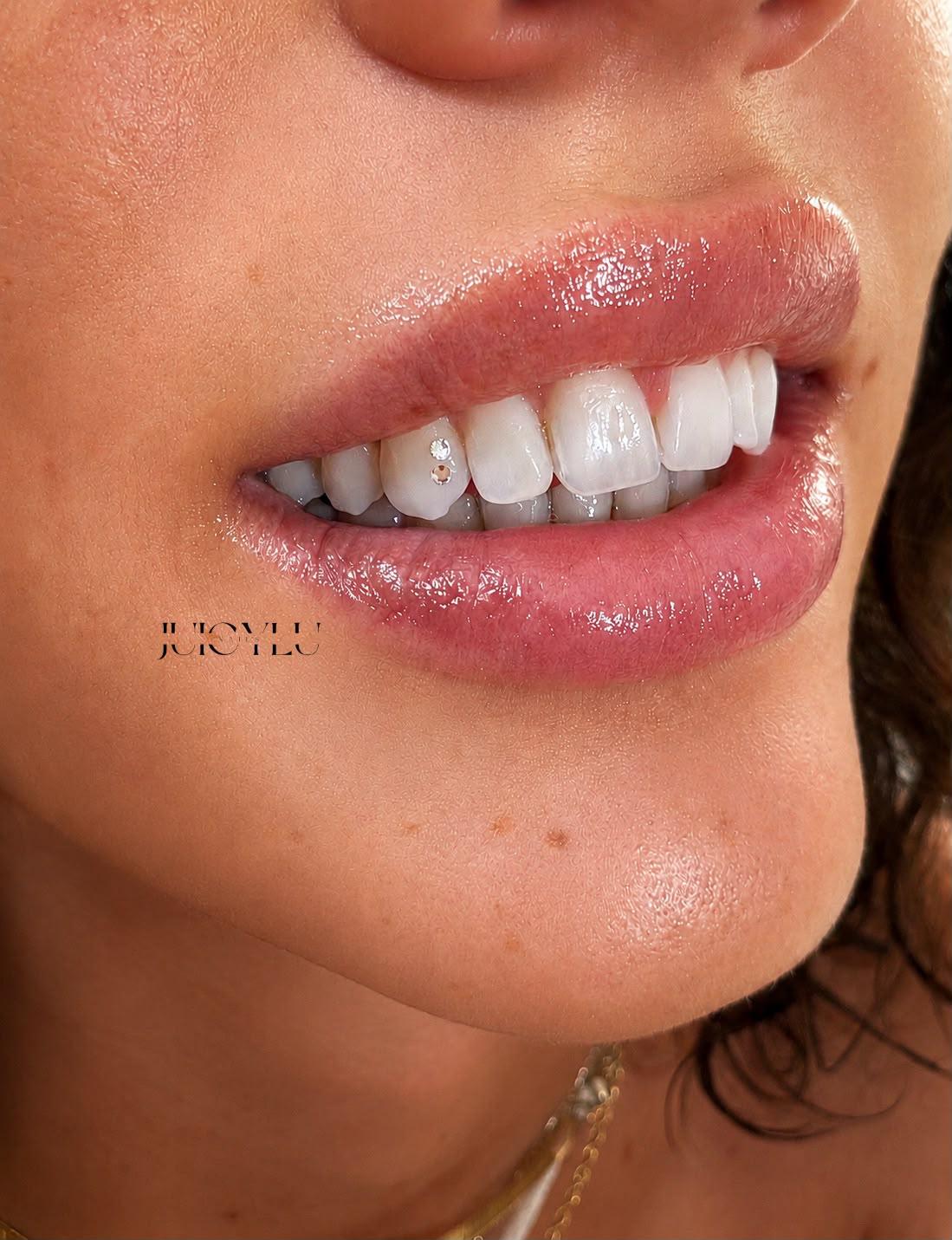 Dezente Tooth Gems von JuicyLuNails