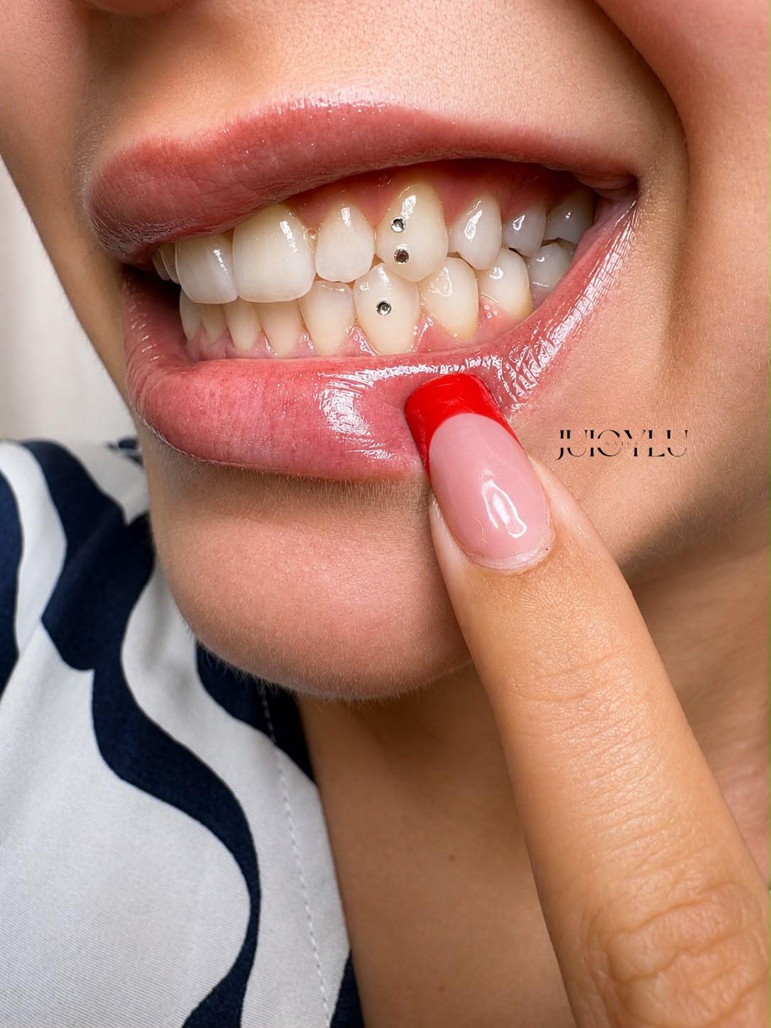 Tooth Gems mit rotem Nageldesign